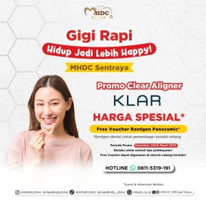clear aligner harga