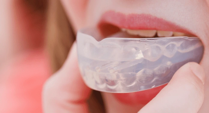 mouth guard gigi retak