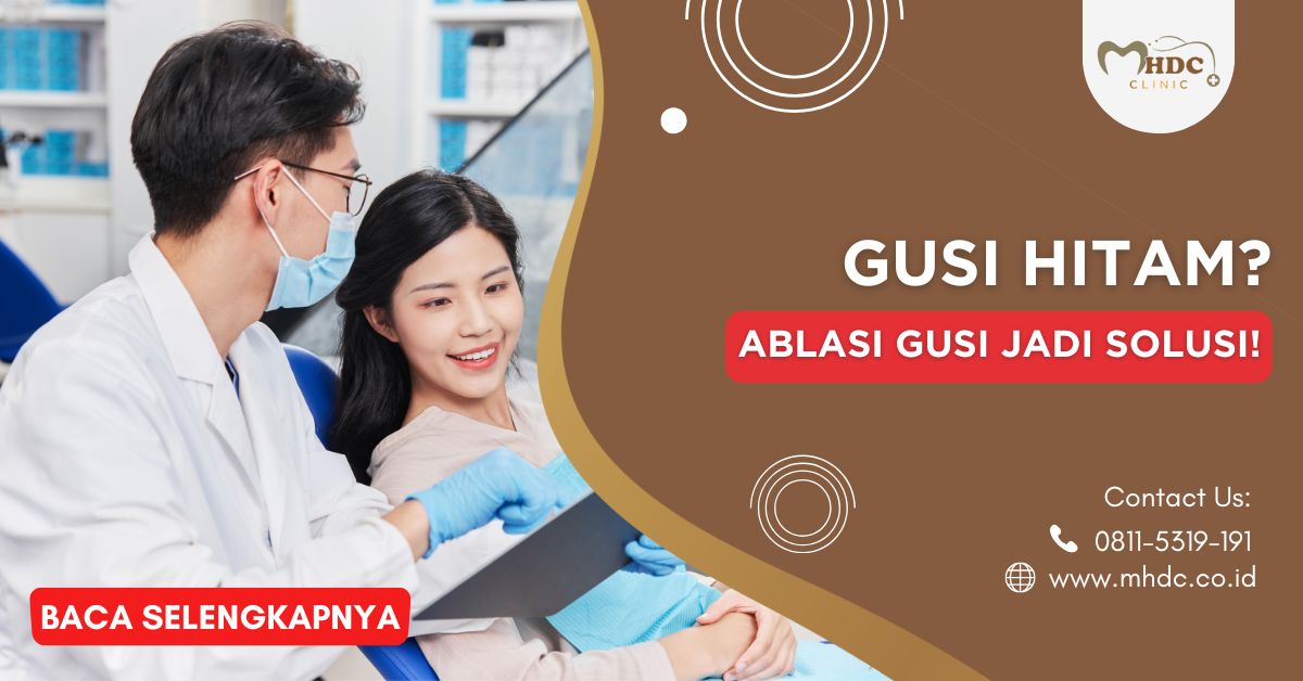 Gusi Hitam? Ablasi Gusi Bisa Jadi Solusi!