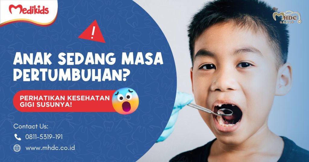 Anak Sedang Masa Pertumbuhan? Perhatikan Kesehatan Gigi Susunya!