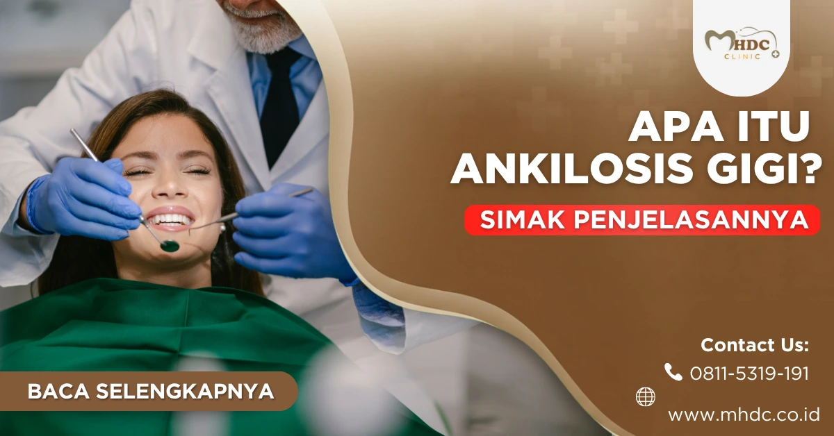 apa itu ankilosis gigi