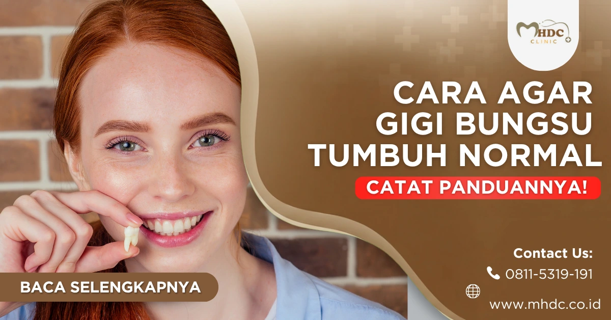 cara agar gigi bungsu tumbuh normal