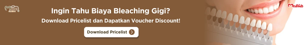 diskon bleaching gigi