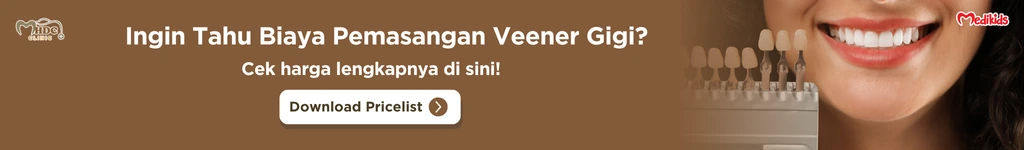veneer gigi murah