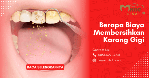 biaya membersihkan karang gigi