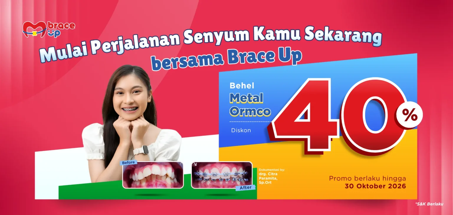 promo pasang behel