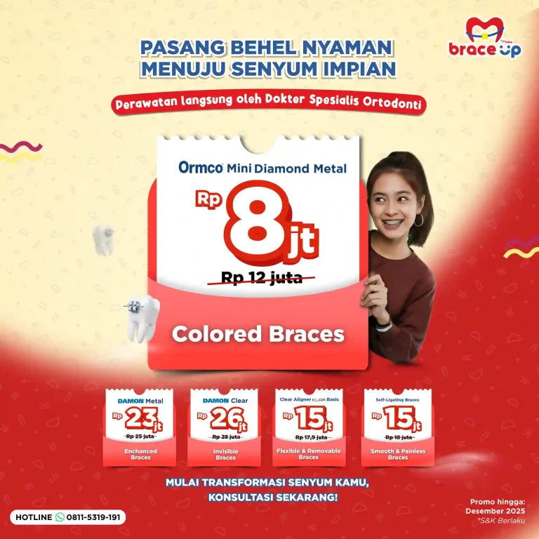biaya pasang behel