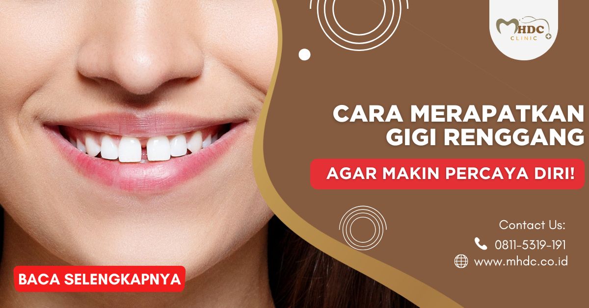 Cara Merapatkan Gigi Renggang agar Makin Percaya Diri!