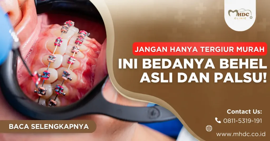 bedanya behel asli dan palsu