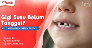 kenapa gigi susu tidak tanggal