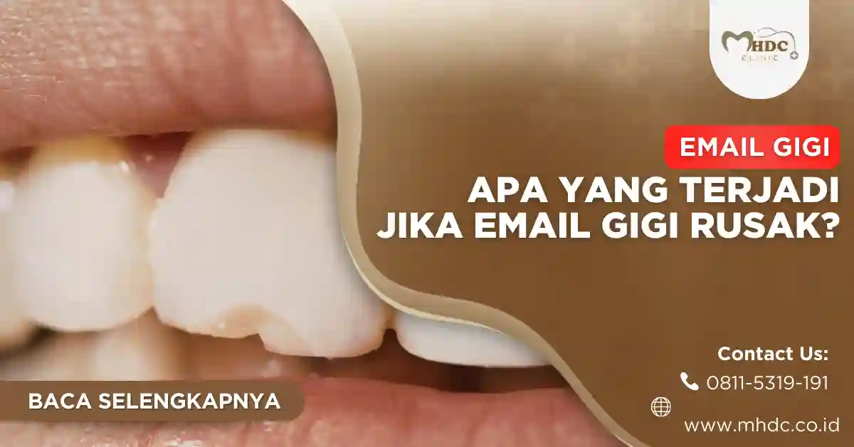 lapisan email gigi