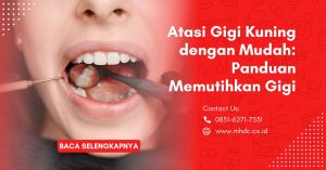 Atasi Gigi Kuning dengan Mudah: Panduan Memutihkan Gigi