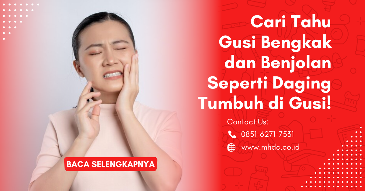 Cari tahu gusi bengkak dan benjolan di gusi