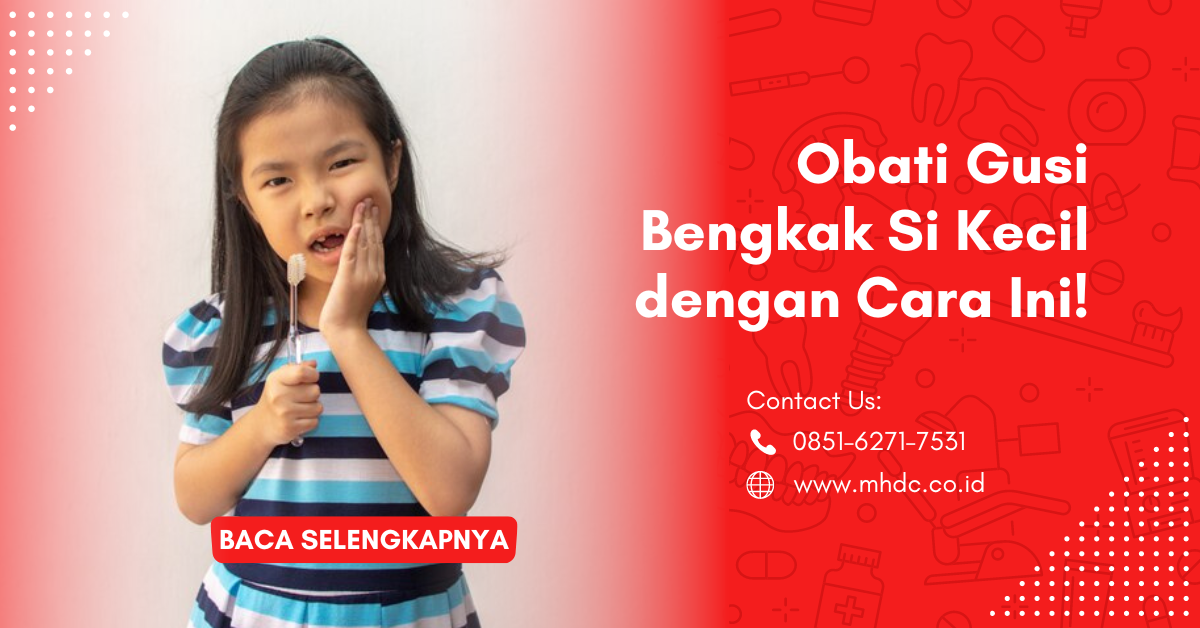 Obati Gusi Bengkak Si Kecil dengan Cara Ini!