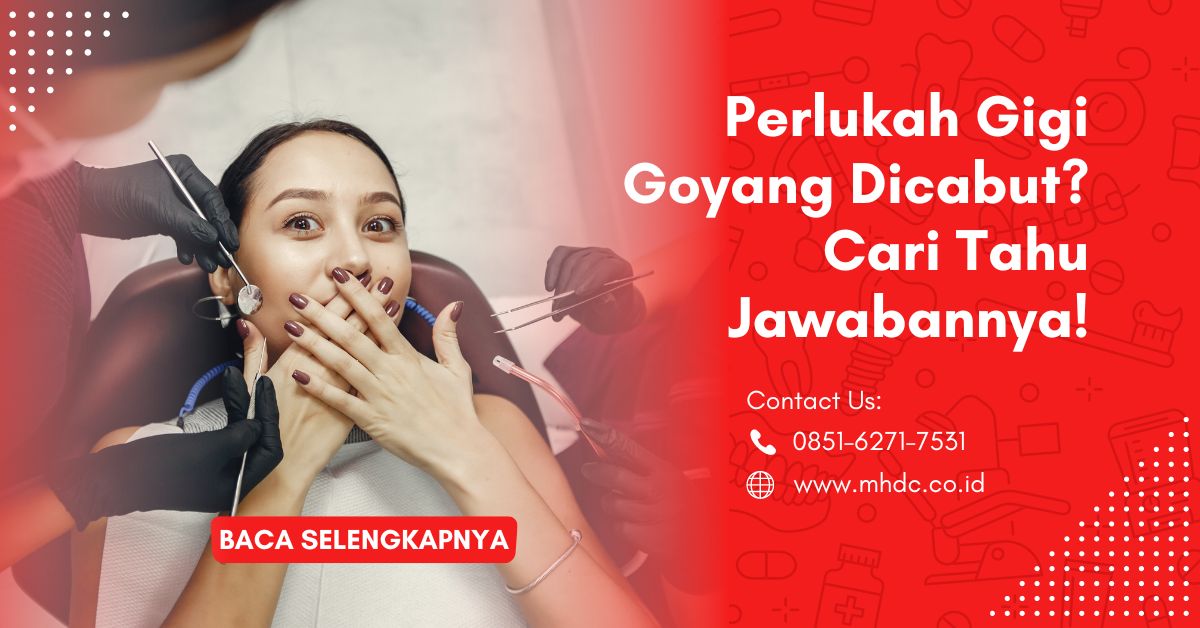 Perlukah Gigi Goyang Dicabut? Cari Tahu Jawabannya!