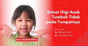 Solusi Gigi Anak Tumbuh Tidak pada Tempatnya