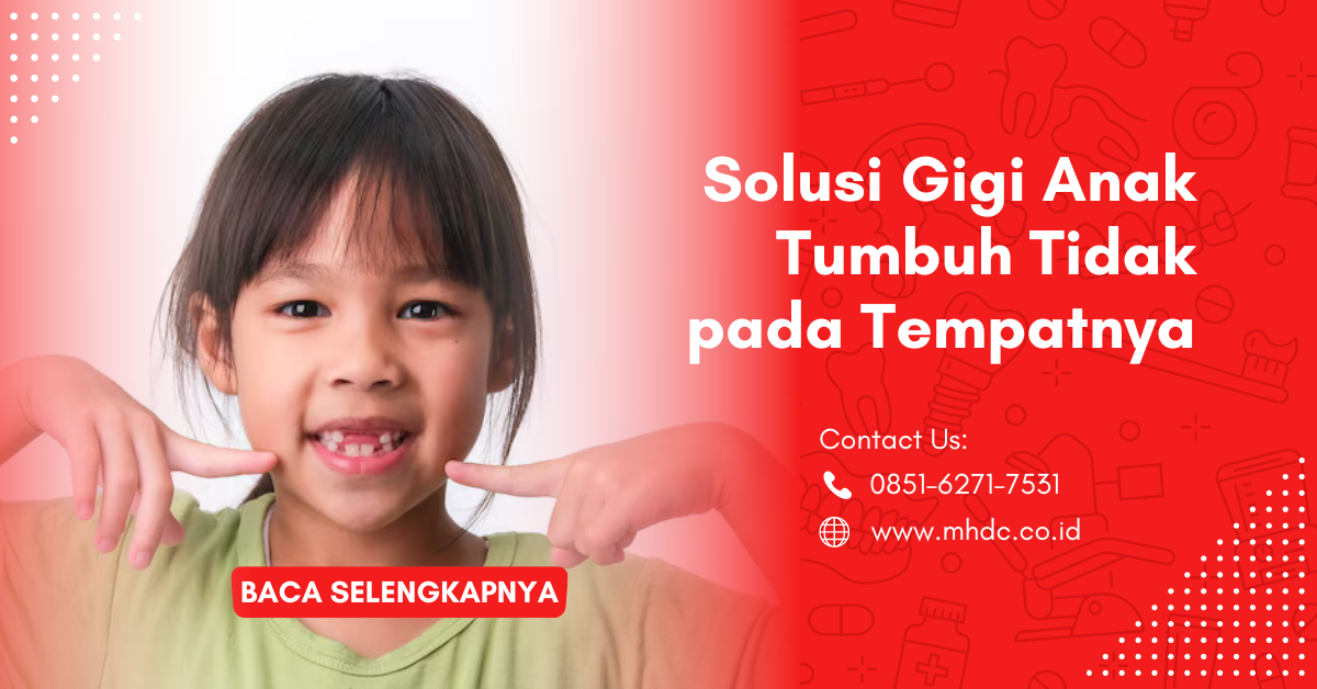 Solusi Gigi Anak Tumbuh Tidak pada Tempatnya