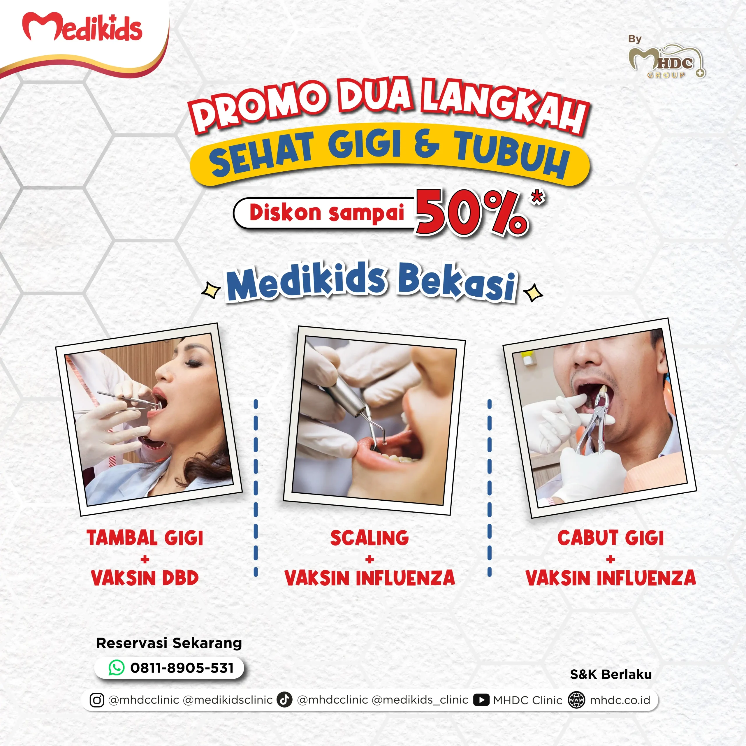 promo scaling medikids bekasi