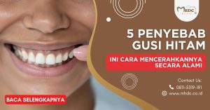 5 Penyebab Gusi Hitam dan Cara Mencerahkannya Secara Alami