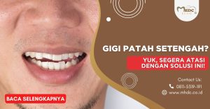 Gigi Patah Setengah? Yuk, Segera Atasi dengan Solusi Ini!