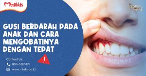 Gusi Berdarah pada Anak dan Cara Mengobatinya dengan Tepat