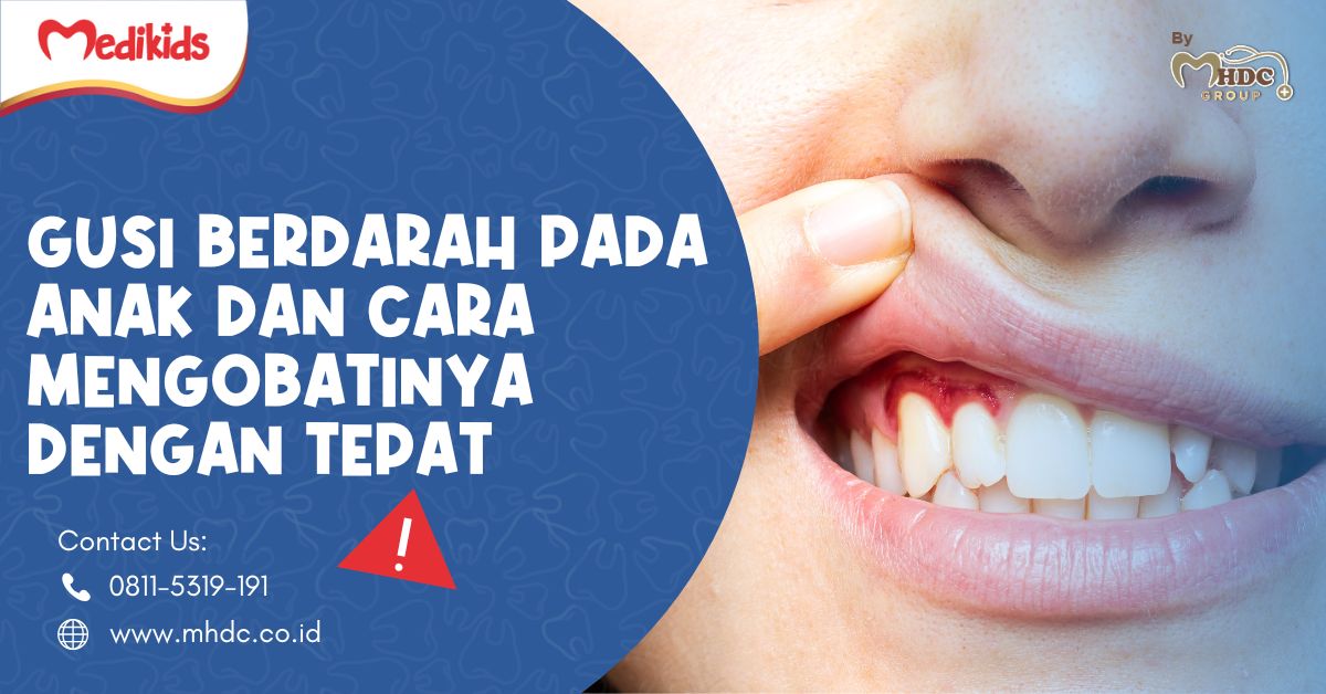 Gusi Berdarah pada Anak dan Cara Mengobatinya dengan Tepat