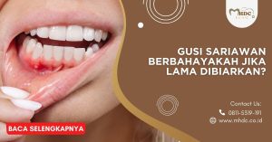 Gusi sariawan berbahayakah jika dibiarkan lama?