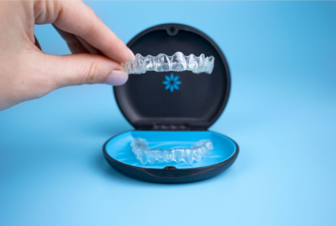 clear aligner