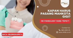 Kapan Harus Pasang Mahkota Gigi? Ini Panduan yang Tepat!