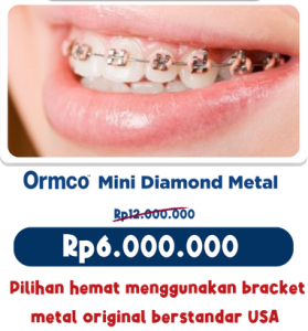 pasang behel murah
