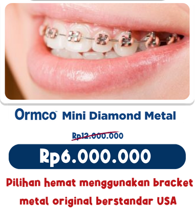 pasang behel murah