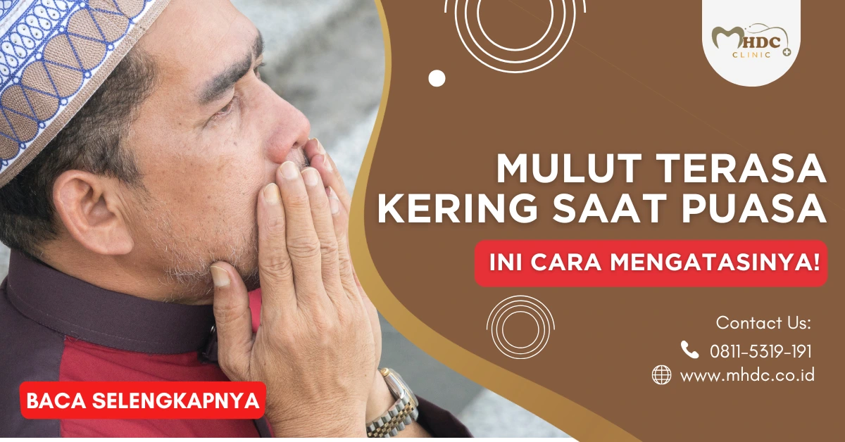 mulut terasa kering