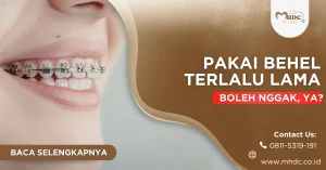 pakai behel terlalu lama, boleh nggak?