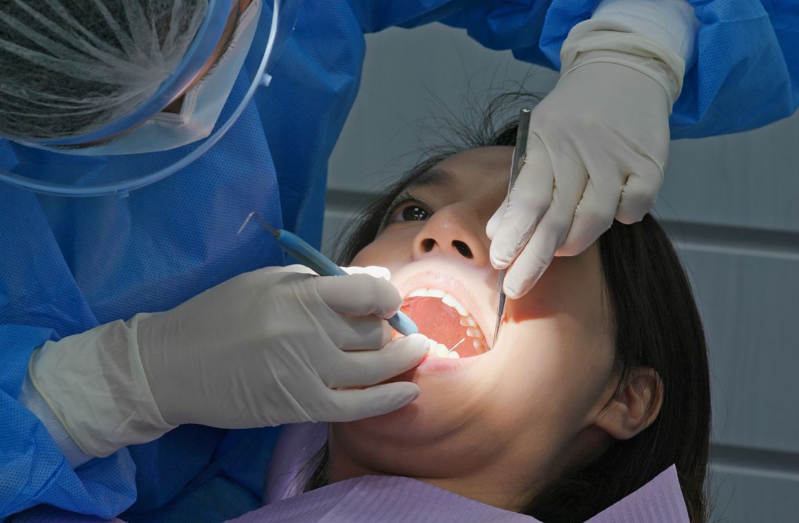 Scaling Gigi Adalah Pengertian Manfaat Dan Prosedurnya 