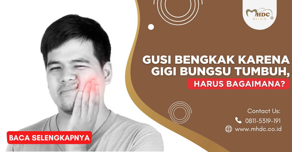 gusi bengkak