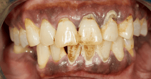 periodonsia adalah