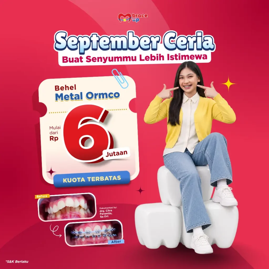 promo pasang behel 6 jutaan