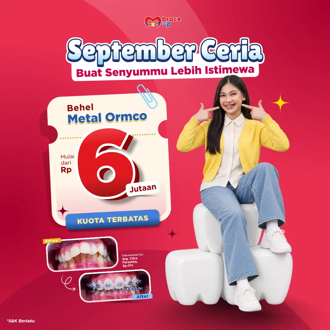 promo pasang behel 6 jutaan