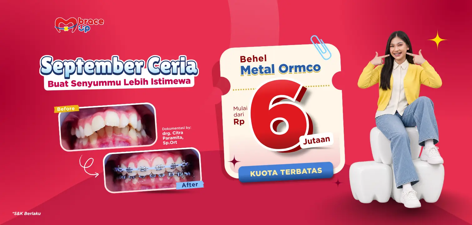 promo pasang behel cuma 6 jutaan