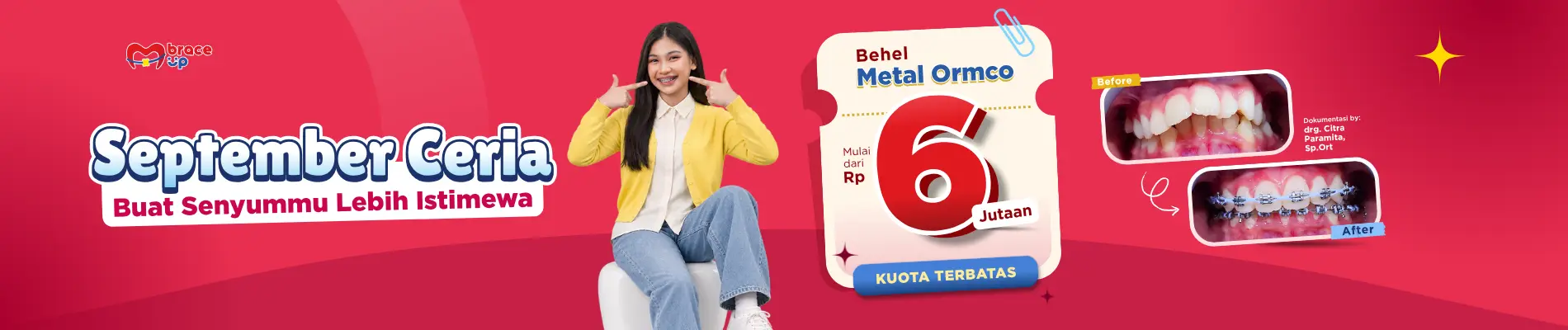 promo pasang behel cuma 6 jutaan