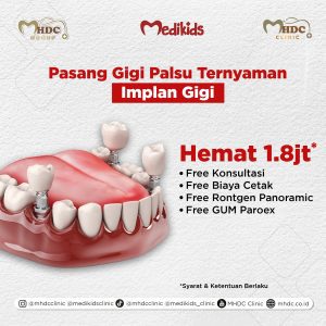 Pasang gigi palsu implan harga diskon