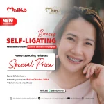 promo self ligating mhdc