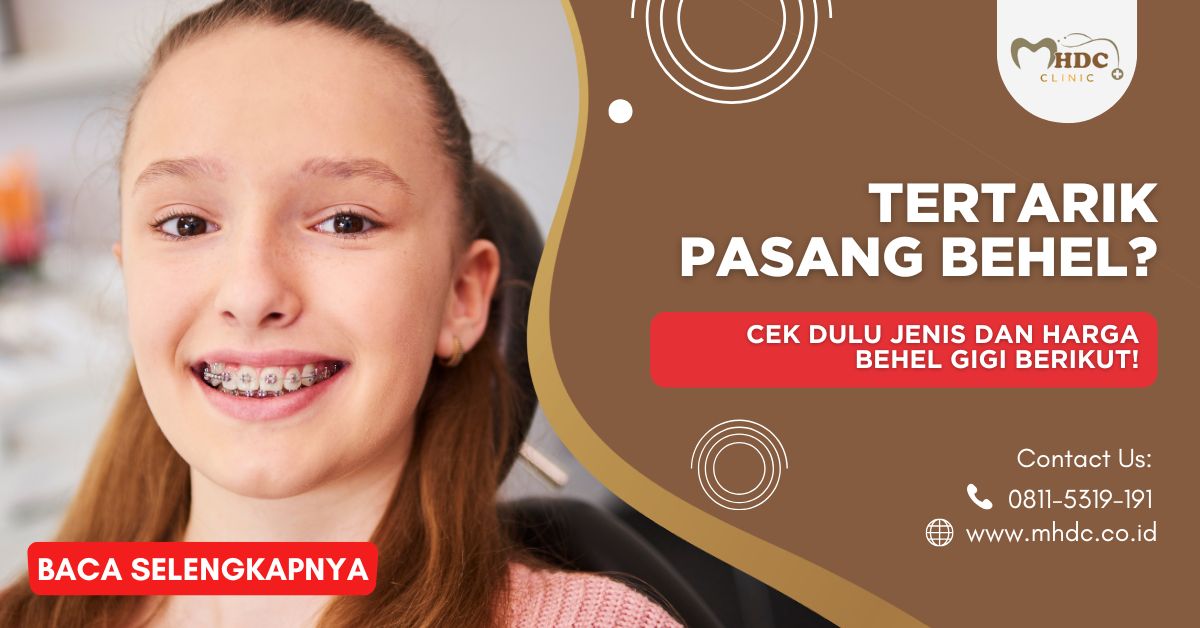 Tertarik Pasang Behel? Cek Dulu Jenis dan Harga Behel Gigi Berikut!