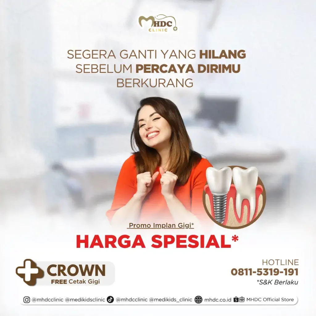 implan gigi