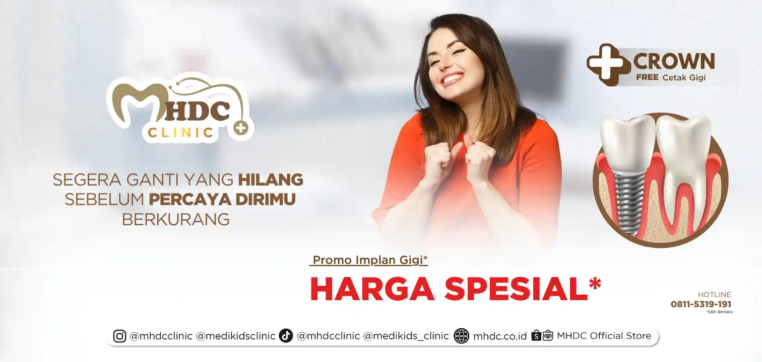 implan gigi adalah