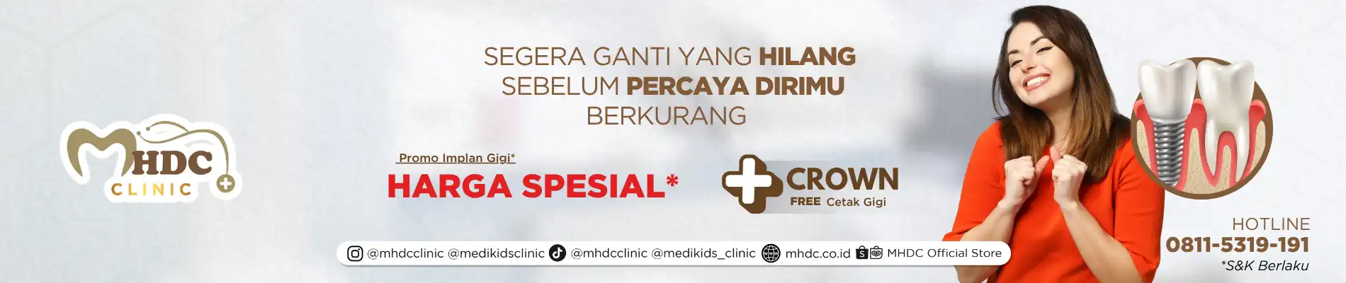 harga implan gigi
