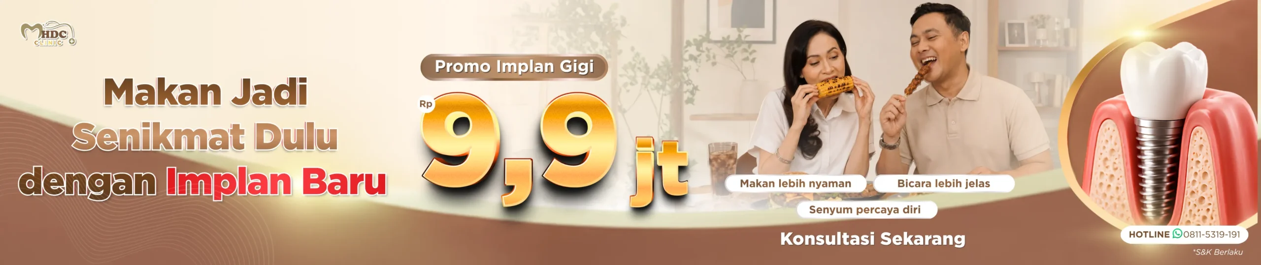 promo implan gigi harga spesial