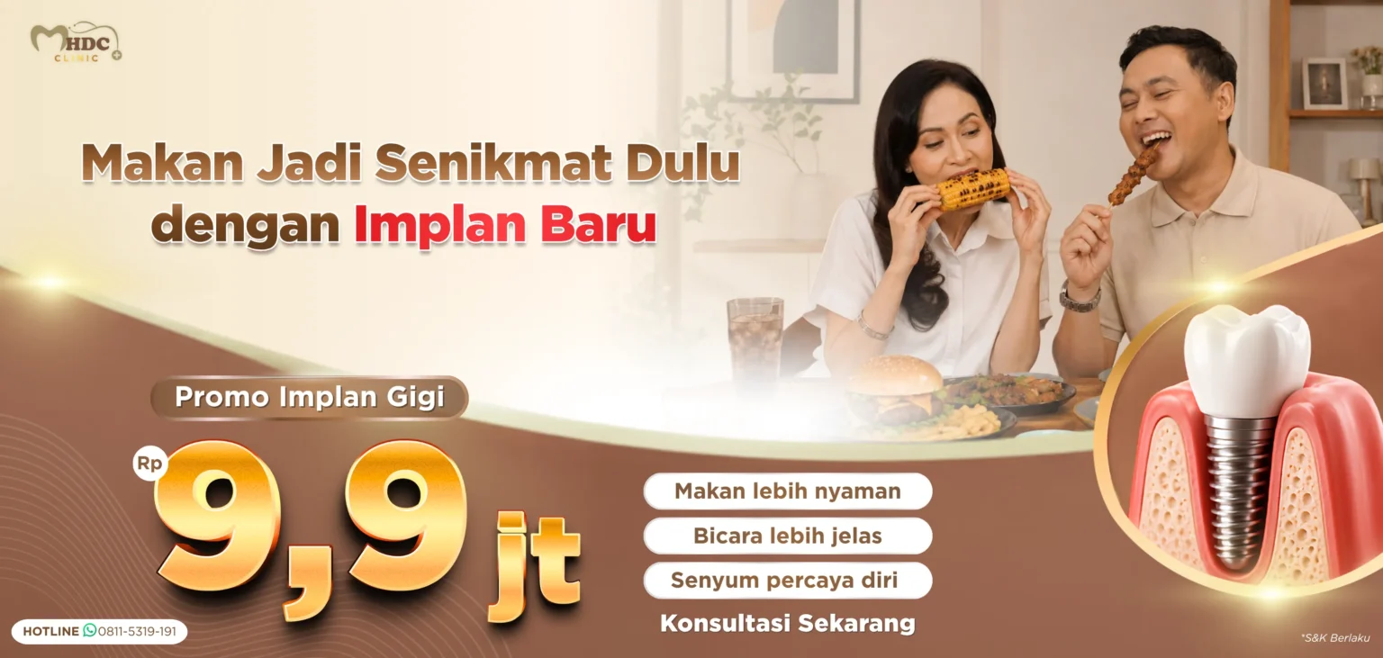 promo implan gigi harga spesial