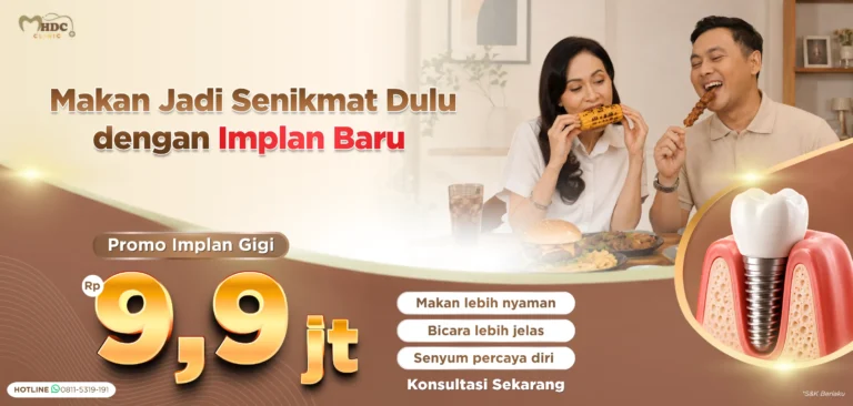 promo implan gigi harga spesial