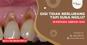 abrasi gigi